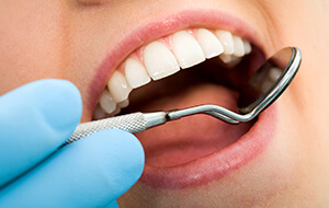 Closeup of teeth during dental exam