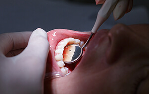 Patient receiving oral cancer screening