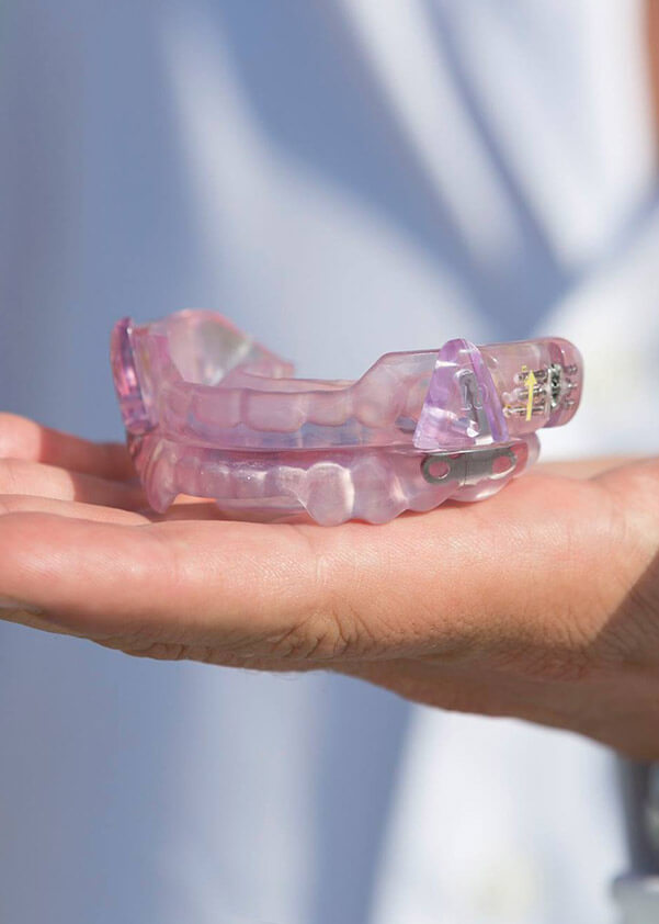 Custom occlusal splint sleep appliance